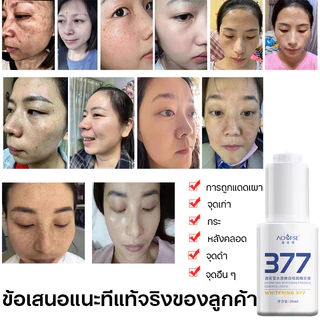 377 ครีมแก้ฝ้ากระ ครีมแก้ฝ้า 30ml ครีมหน้าขาว ครีมปรับปรุงผิว ครีมบำรุงผิว ไวท์เทนนิ่ง ครีมแก้ฝ้าไวท์เทนนิ่งผิว ครีมแก้ฝ