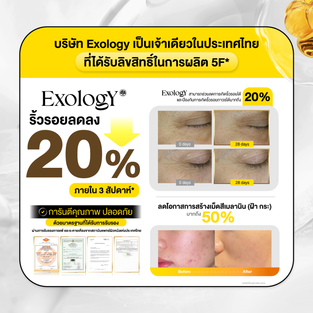 โปร 3 แถม 6 Exology Anti-Aging Crem ลดเลือนริ้วรอย เติมเต็มร่องลึก