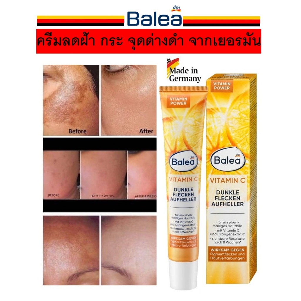 ครีมทาฝ้า กระ จุดด่างดำ ลบเลือนจุดด่างดำ ทำให้หน้าขาวใสขึ้น ของแท้!!! จากเยอรมัน Balea Dunkle Flecken Aufheller
