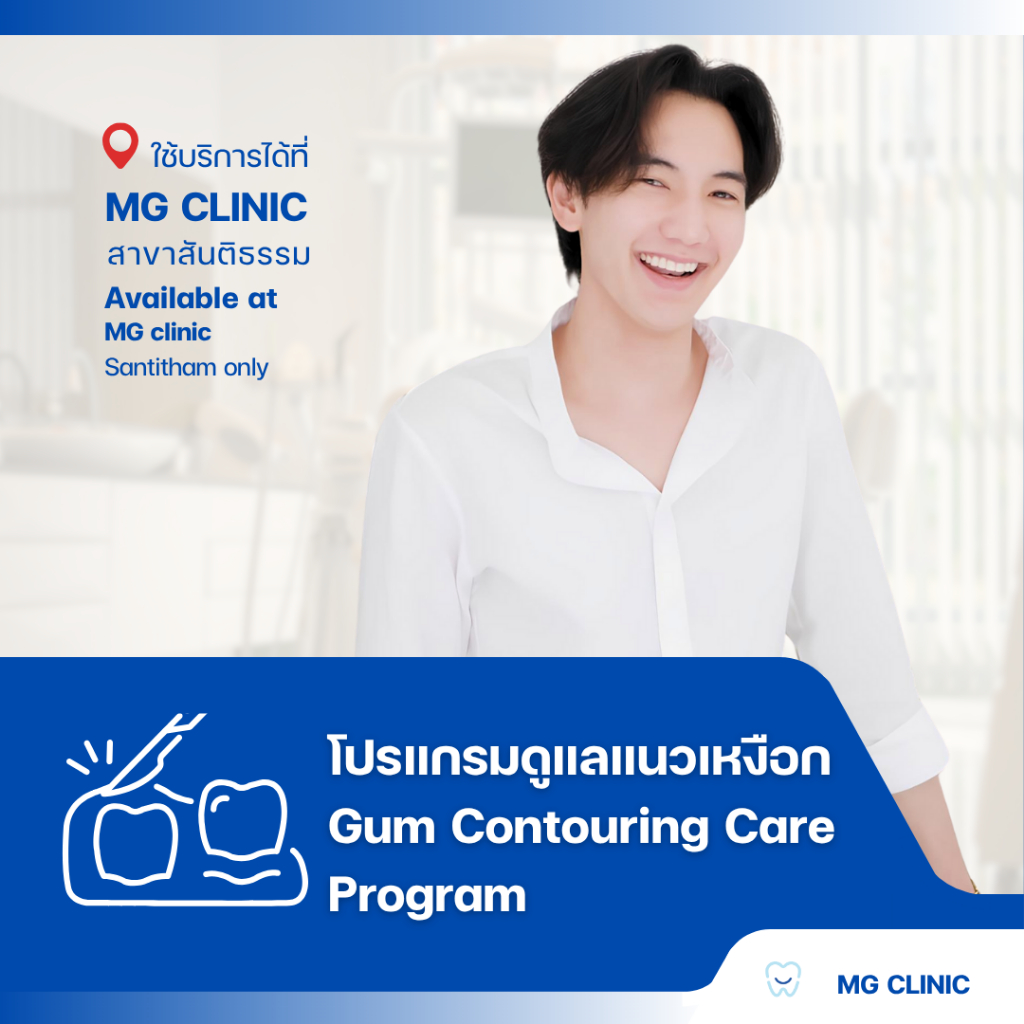 โปรแกรมดูแลแนวเหงือก (Gum Contouring Care Program) - MG Dental Clinic