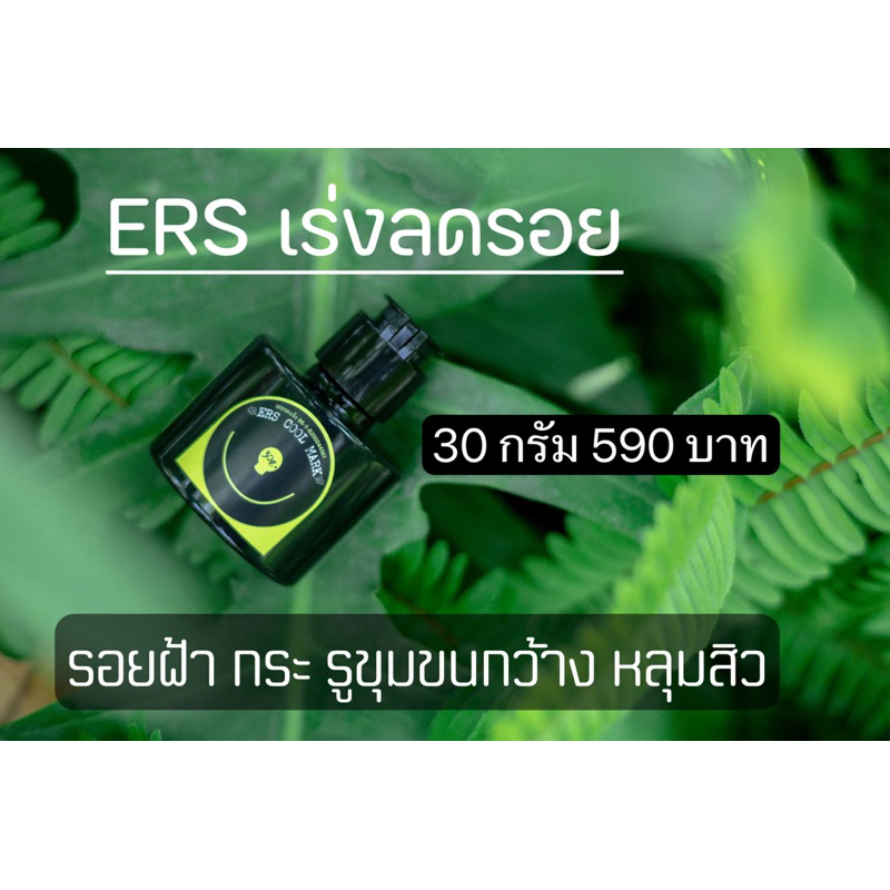 Ers  ตัวเร่งลดรอยดำติดสปีด