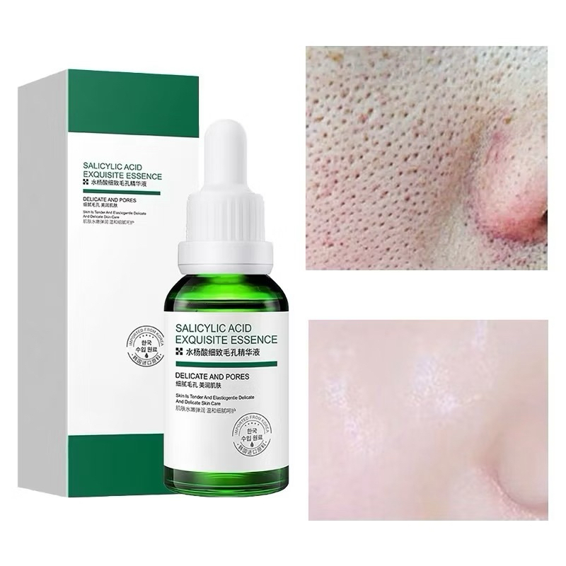 Salicylic Acid Pore Rinning Serum Moisturizing Nourishing Firming Whitening Facial Skin Care 30ml(T77)
