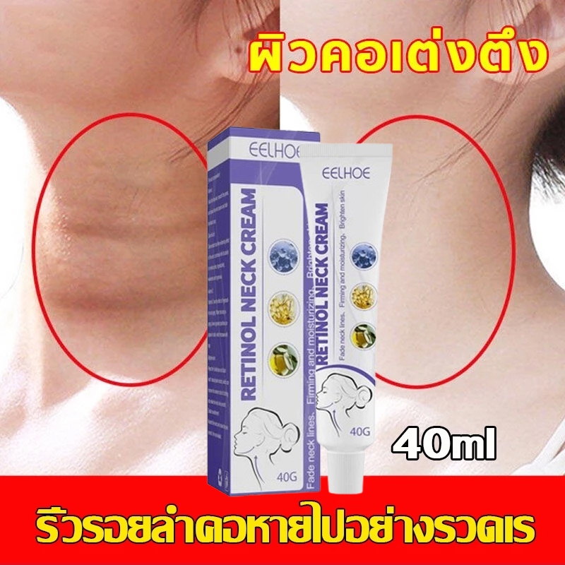 ครีมทาคอ ครีมเรตินอลคอ ไวท์เทนนิ่งและกระชับผิวคอ เอสเซนส์เรตินอล มอยส์เจอร์ไรเซอร์และไฮเดรติ้ง 40g ไวท์เทนนิ่ง ลดเลือนริ