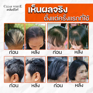 DKUB Clear White ดีคับ เคลียร์ไวท์ แชมพูปิดผมหงอก แชมพูปิดผมขาว สระง่าย สีติดทนนาน