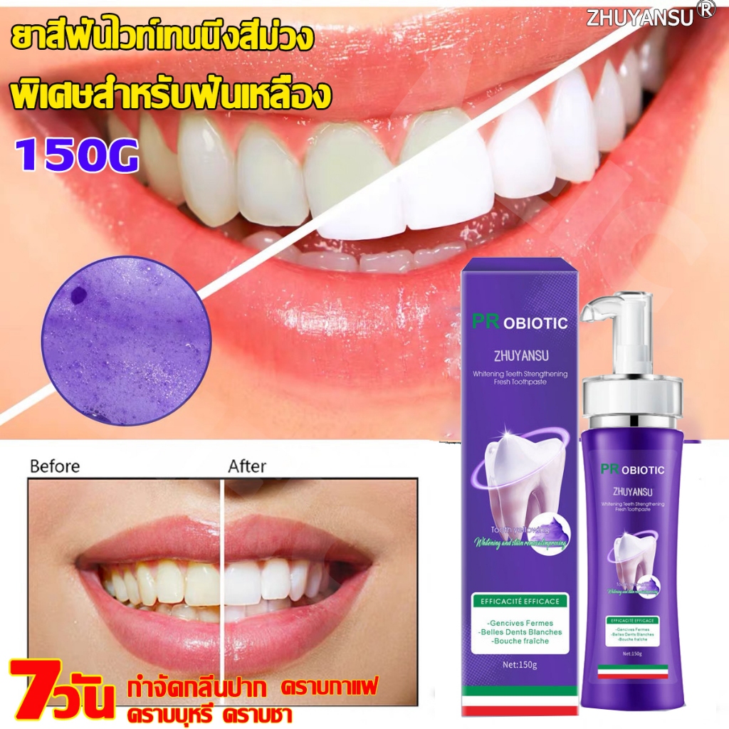ZHUYANSU ยาสีฟันฟันขาว 150g ยาสีฟันโปรไบโอติก ช่วยลด หินปูน ฟันเหลือง ลดกลิ่นปาก ปกป้องเหงือก