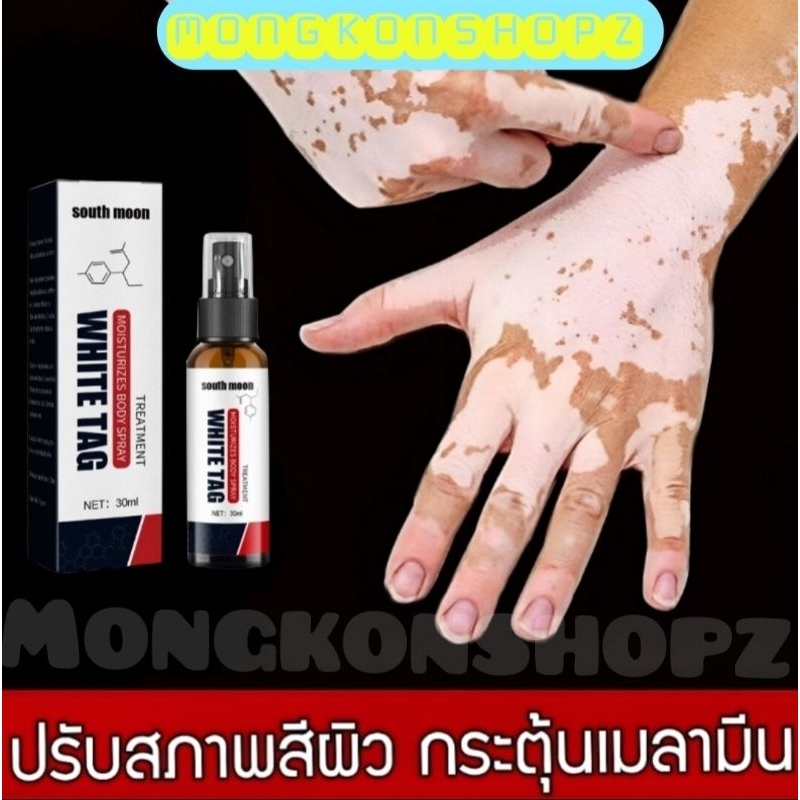 แถมฟรี!ครีมทาด่างขาว สเปรย์ด่างขาว ด่างขาวตามร่างกาย ซ่อมแซมดูแลผิว ปรับสภาพเม็ดสีของผิวได้อย่างมีประสิทธิภาพ