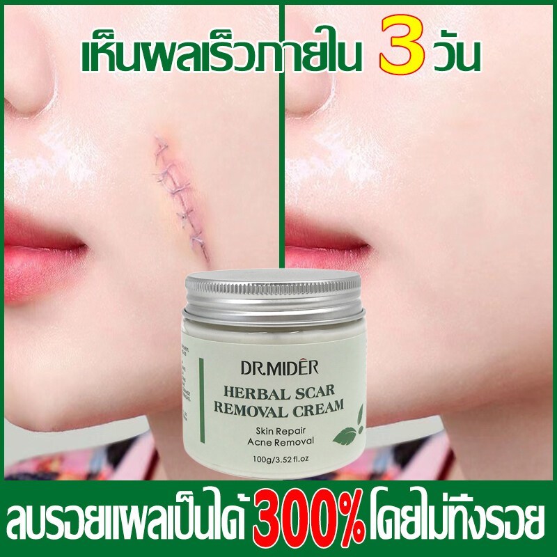 ครีมลดรอยแผลเป็น ครีมลดแผลเป็นครีมลดรอยแผลเป็น 100 กรัม ครีมแผลเป็น เจลซ่อมแซม เจลรอยแผลเป็น รอยแผลเป็น รอยแผลเป็น แผลผ่