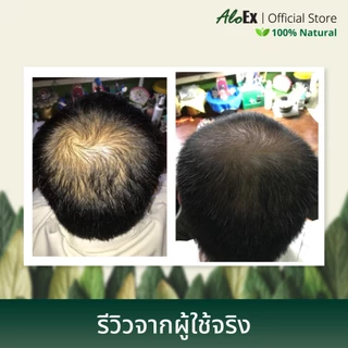 [รีวิวปัง] AloEx Original Shampoo 1 ขวดและ AloEx Hair Serum 50 ml. 1 ขวด เซตแชมพูและเซรั่มบำรุงผม ลดผมร่วงสำหรับผมมัน