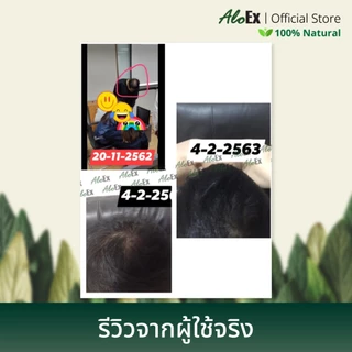 [แพ็คสุดคุ้ม] AloEx Organic Original Shampoo 3 ขวด แชมพูลดผมขาดร่วง สำหรับผมมัน-เหงื่อออกง่าย