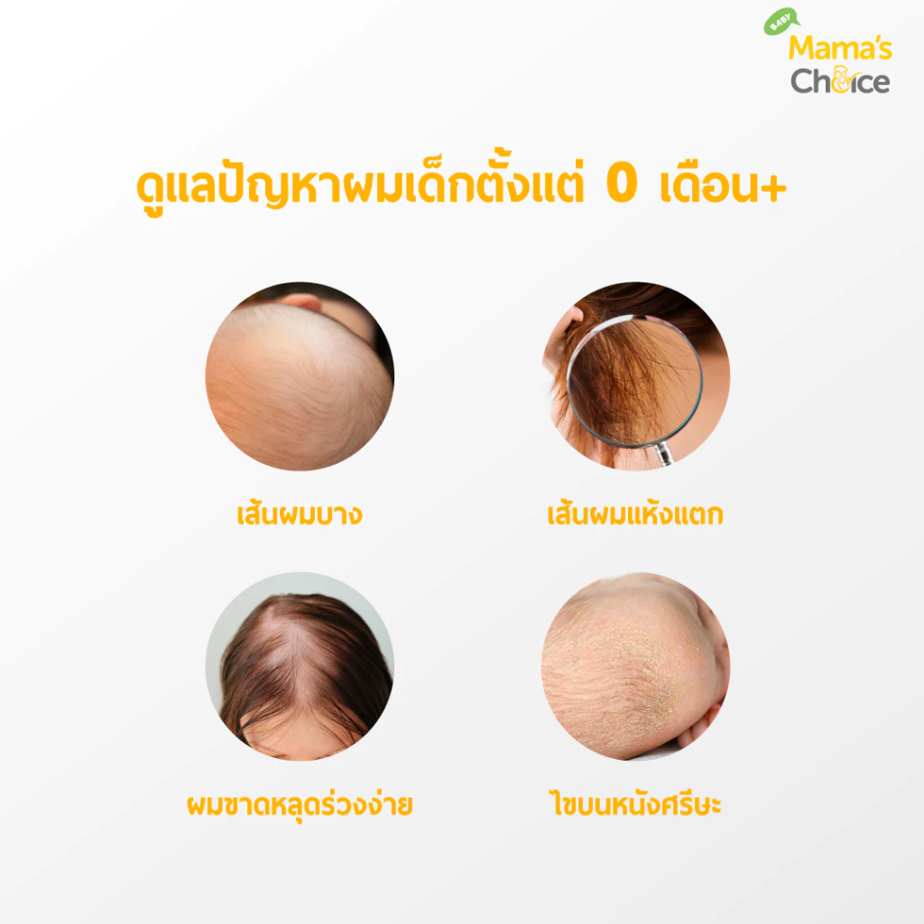 Mama's Choice โลชั่นบำรุงผม วิตามินบำรุงผมเด็ก ป้องกันหนังศีรษะแห้ง Organic ให้ผมหนา ดกดำ - Baby Hair Vitamin Lotion thumbnail 6