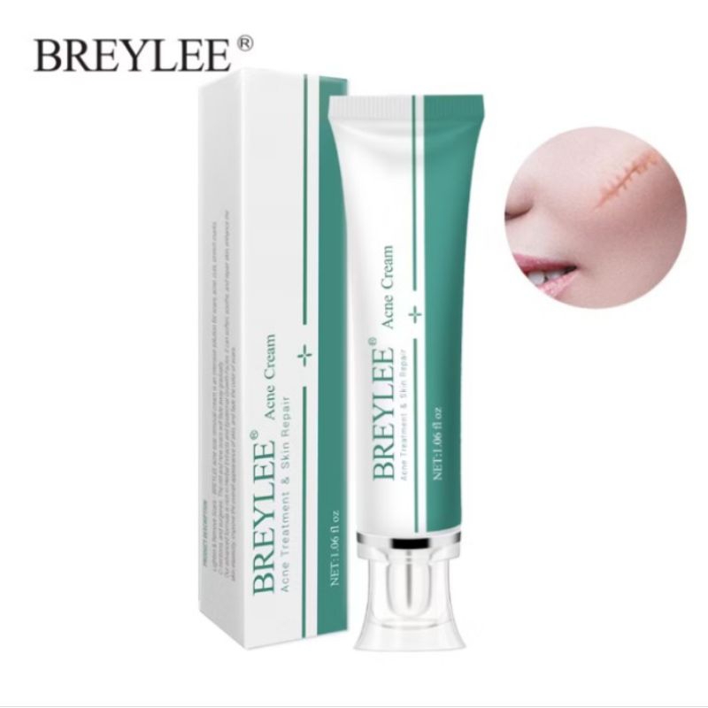 BREYLEE Scar Removal Gel 30g ครีมลดรอยแผลเป็น ลดผิวแตกลาย ลบรอยแผลเป็น ลดเลือนป้องกันรอยแผลเป็น Repair Scar Cream 30g
