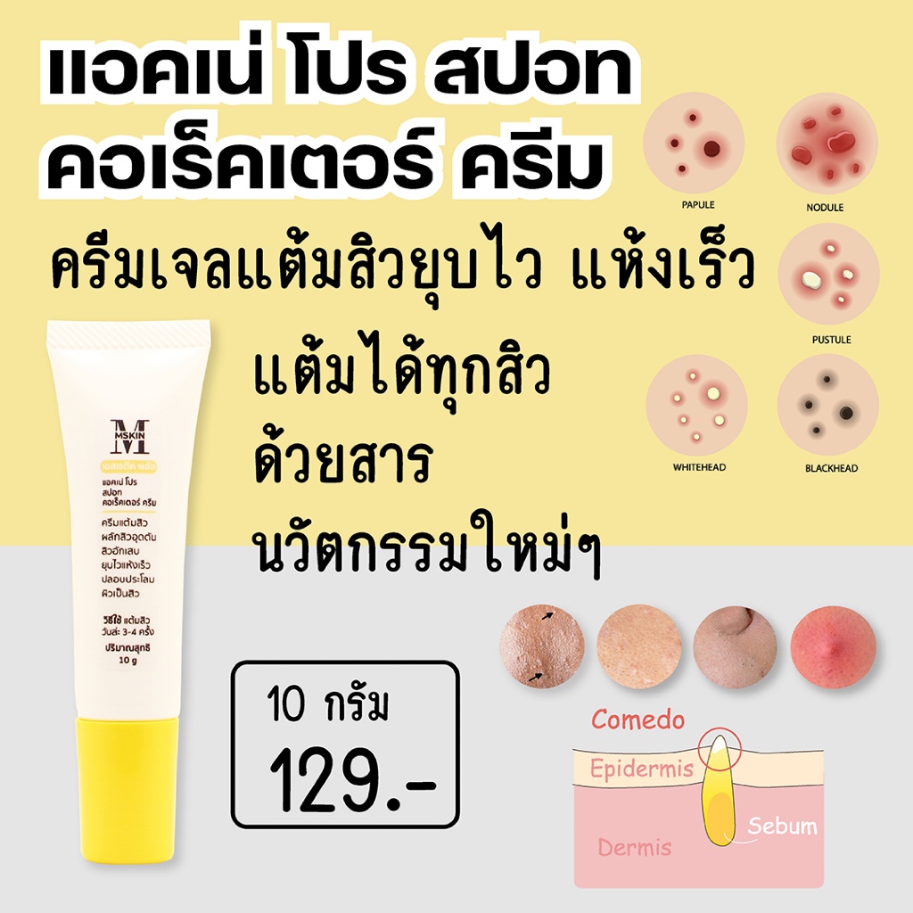 แอคเน่ โปร สปอท คอเร็คเตอร์ ครีมเจลแต้มสิว อุดตัน อักเสบ สิวยุบไว แห้งเร็ว AC01
