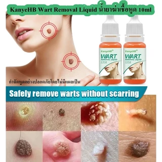 น้ำยาฆ่าเชื้อหูด 10ml KanyeHB's wart-removing liquid หูดหลุดได้อย่างรวดเร็ว