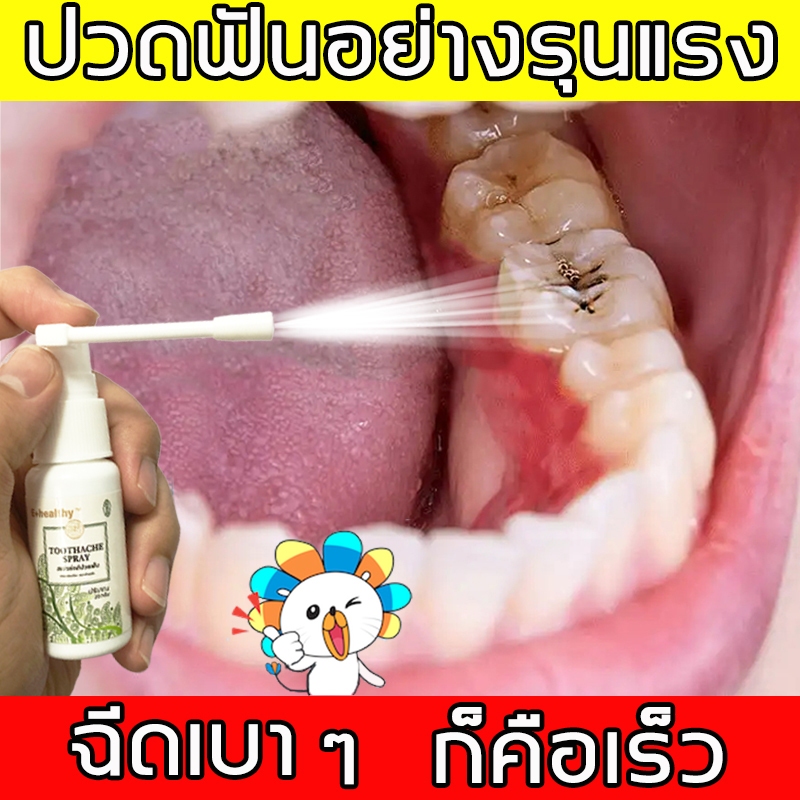 YIMIWEILAI สเปรย์แก้ปวดฟัน แก้ปวดฟัน เหงือกอักเสบ ใช้หมดก็เห็นผล ช่วยลดอาการเจ็บฟันได้เป็นอย่างดี สเปรย์พ่นคอ ปวดฟัน