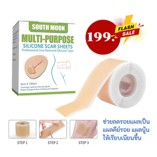 ส่งไว++++South Moonเทปซิลิโคนเจลรักษารอยแผลเป็น แผ่นแปะแผลเป็น 4cm*150cm กําจัดรอยแผลเป็นจากแผลเป็น
