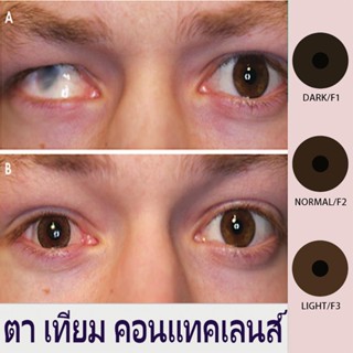 ตา เทียม คอนแทคเลนส์ คอนแทคเลนส์สำหรับผู้พิการทางสายตา （2 ชิ…