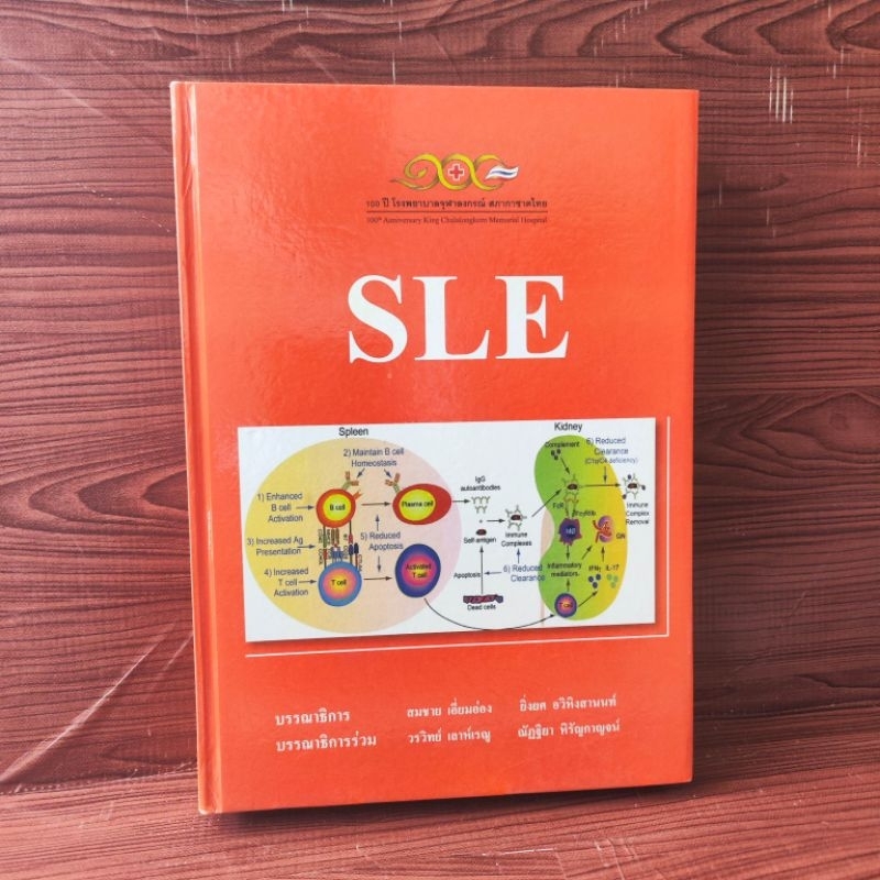 SLE โรคลูปัส Systemic Lupus Erythematosus