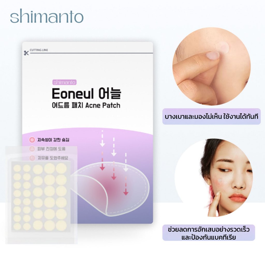 Shimanto แท้ แผ่นแปะสิว กันน้ำกันเหงื่อ ไม่มันเงา ผิวแพ้ง่ายใช้ได้ รักษาและปกปิดสิวอักเสบ - 2