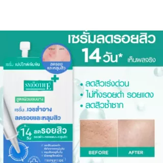 1กล่อง 6 ซอง Smooth E ACNE SCAR SACHET 5 G. สมูทอี สการ์ แบบซอง 5 กรัม
