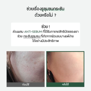 [Blanc Nature] Acne Removal Foam Cleanser โฟมล้างหน้ารักษาสิว ชาเขียวออร์แกนิก, ฮาร์ทลีฟ, ทีทรี
