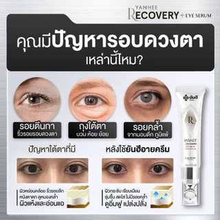 Yanhee Recovery Eye Serum ยันฮี รีโคฟเวอรี่ อาย เซรั่ม ถุงใต้ตา บำรุง ผิวรอบดวงตา ภูมิแพ้ ใต้ตาดำ