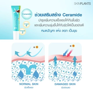 SKINPLANTS Defenza Cream 12 g.ครีมแก้แพ้ธรรมชาติ ลดผิวติดสารแก้คัน ผดผื่นเซ็บเดิร์ม บรรเทาการอักเสบ