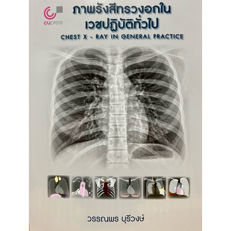 9789740343653 c112 ภาพรังสีทรวงอกในเวชปฏิบัติทั่วไป (CHEST X-RAY IN GENERAL PRACTICE)