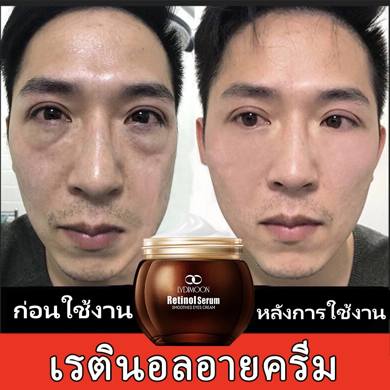 ครีมบำรุงรอบดวงตา ครีมลดริ้วรอย อายครีม ลดริ้วรอย ใต้ตาดํา ครีมเรตินอล ทาใต้ตา บํารุงใต้ตา eye cream 35g