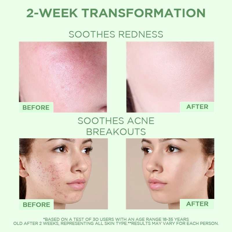PAZIUM มาร์คหน้า มาส์กโคลน Cleansing Mask ทำความสะอาดลึก ดูดซับความมัน ไม่แห้งผิวลดสิวหัวดำ ความมัน 42G thumbnail 9