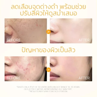 SKINTIFIC Vitamin C Brightening Glow Serum วิตามินซี ไบร์ทเทนนิ่ง โกลว์ เซรั่ม เซรั่มบํารุงผิวหน้า