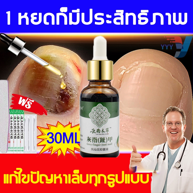 เห็นผลภายใน7วัน🔥ฆ่าเชื้อราที่เล็บ เซรั่มบำรุงเล็บ ยาเชื้อราเล็บ ซรั่มรักษาเล็บ เชื้อราเล็บ ครีมบำรุงเล็บ ยาฆ่าเชื้อราเล็
