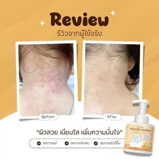 HOPPA Organic Herbal Bath and Shampoo โฟมอาบน้ำสระผมออร์แกนิก สมุนไพรขมิ้น สำหรับเด็ก