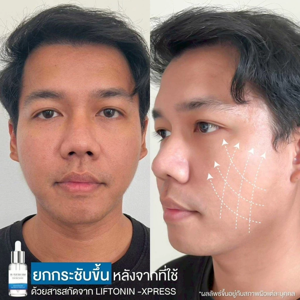 โปร 4ขวดแถม1 B Serum Skincare บีเซรั่มสกิลแคร์ หน้าตรึงสกินแคร์ เซรั่มบำรุงผิว thumbnail 5