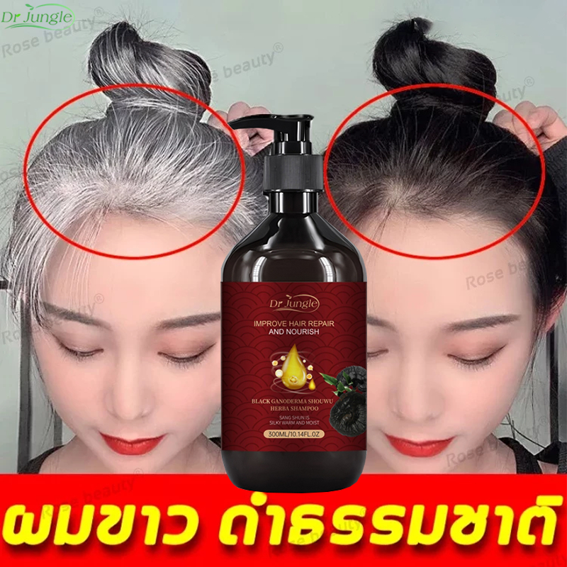 【ซื้อ2แถม1】แชมพูปิดผมหงอก แชมพูแก้ผมหงอก 300ml ส่งเสริมการเจริญเติบโตของเส้นผมสีดำ แชมพูสระผมดำ ยาสระแก้ผมหงอก