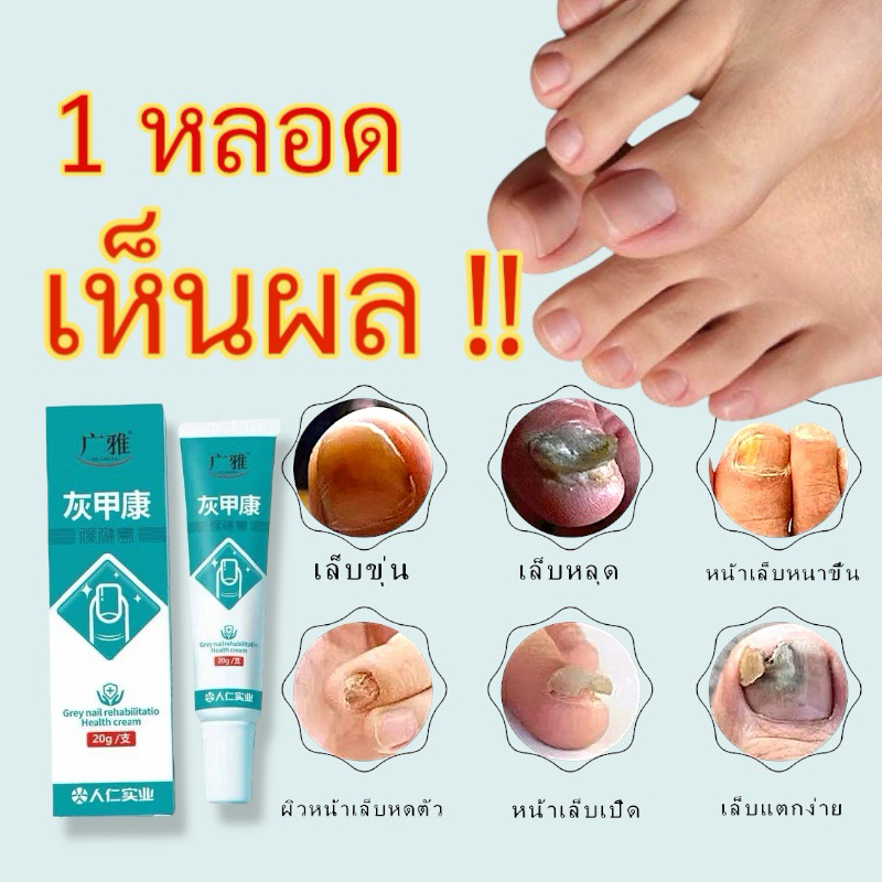 💅🏻เซรั่มบำรุงเล็บ รักษเชื้อราที่เล็บ เล็บขบ ซ่อมแซมเล็บ ทำให้เล็บกลับมาสวย ปริมาณI 20g.