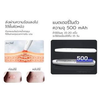 So Chill เครื่องลดคัน ลดบวมจากแผลยุงกัด ไม่มีสารเคมี ปลอดภัย คนมีครรภ์ เด็กเล็กสามารถใช้ได้ พกพาสะดวก ใช้ง่าย