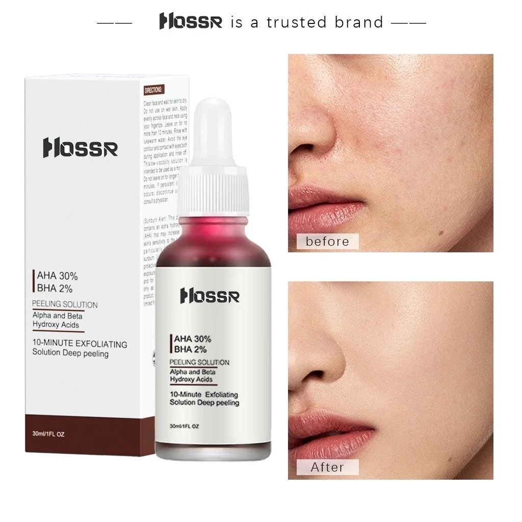 มาส์กแดง หน้าใส AHA HOSSR AHA 30% + BHA 2% ผลิตภัณฑ์ดูแลผิวหน้า กําจัดสิว ควบคุมความมัน 30 มล.