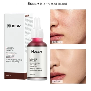 มาส์กแดง หน้าใส AHA HOSSR AHA 30% + BHA 2% ผลิตภัณฑ์ดูแลผิวหน้า กําจัดสิว ควบคุมความมัน 30 มล.