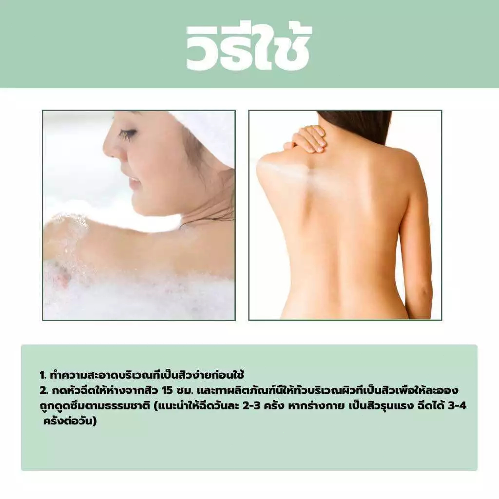 Jaysuing สิวที่หลัง แอคเน่ สเปรย์ฉีดแผ่นหลังและลำตัว ลดไรและสิวตามร่างกาย กำจัดสิวที่หลังและลำตัว ครีมแต้มสิว acne spray - รูปที่ 5