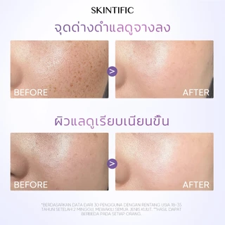 【SKINTIFIC】Anti Dark Spot Serum Symwhite 377 เซรั่ม เซรั่มบํารุงผิวหน้า เซรั่มหน้าขาวใส เซรั่มหน้าเงา