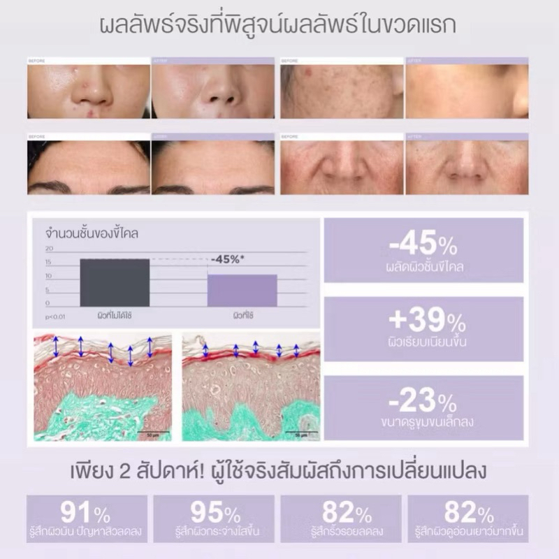 ISDINCEUTICS SALICYLIC RENEWAL SERUM 30ML เซรั่มเคลียร์สิว คุมมัน พร้อมฟื้นฟูผิวใหม่ เลือนริ้วรอย - รูปที่ 3