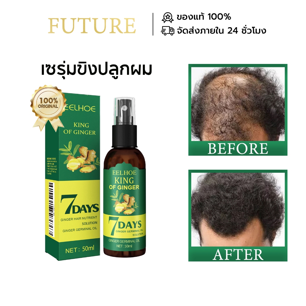 EELHOE สเปรย์ปลูกผม ยาปลูกผม น้ำยาปลูกผม เซรุ่มขิงปลูกผม เซรั่มปลูกผม ของแท้ Ginger hair growth serum เซรั่มปลูกผมดก