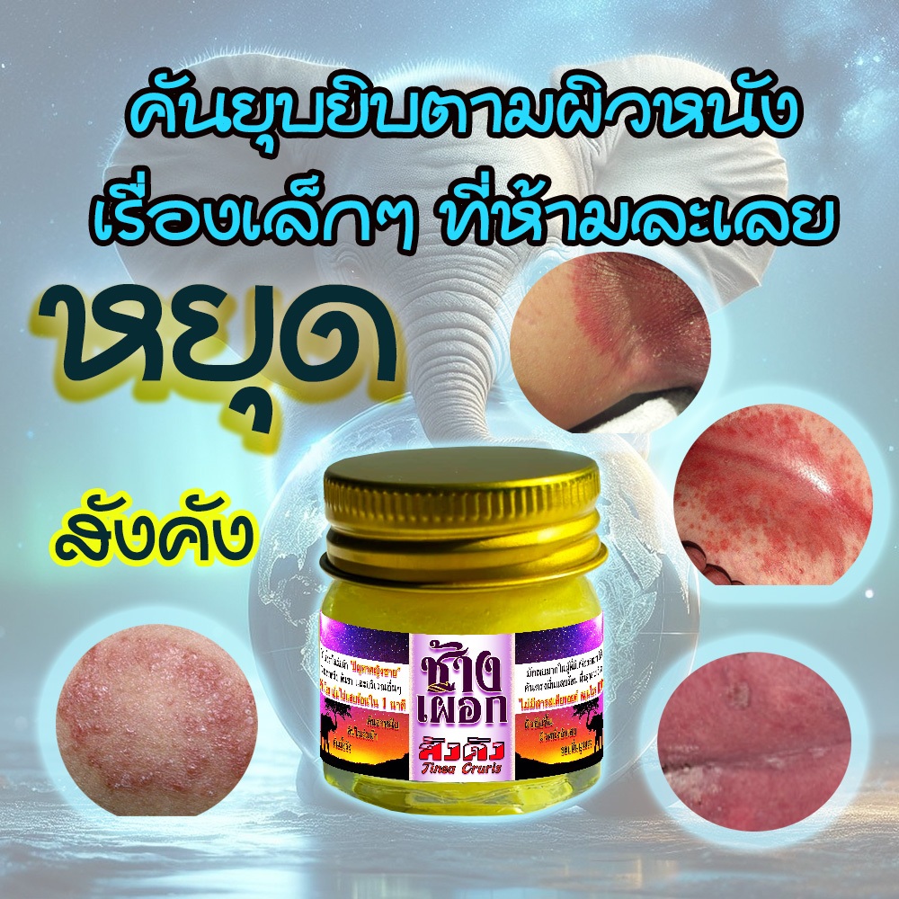 ใครเป็นสังคัง อยู่รีบใช้เลย ก่อนเป็นหนัก บอกลา สังคังในร่มผ้า ใช้ง่าย แค่ทาทุกวัน