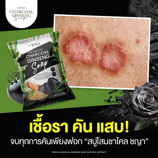 สบู่โสมชาโคล แบรนด์ชญา(คัน ผดผื่น กลากเกลื้อน เชื้อรา)