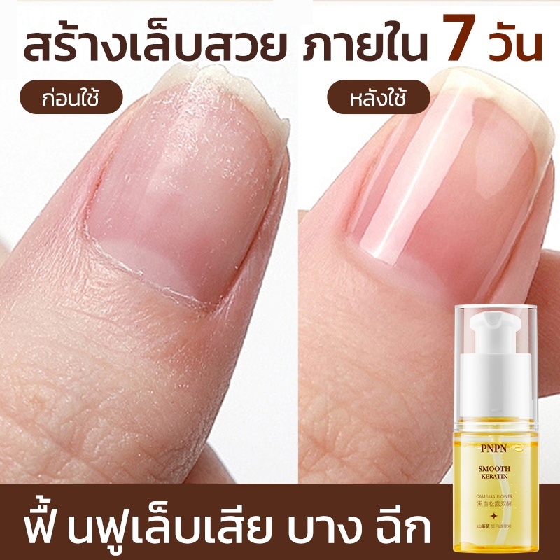 [ขายดี]เซรั่มบำรุงเล็บ น้ำยาบำรุงเล็บ 30ml Nail Care Fliud เล็บ บํารุงเล็บ ซ่อมแซมเล็บแตก เล็บเปราะ เล็บหนา
