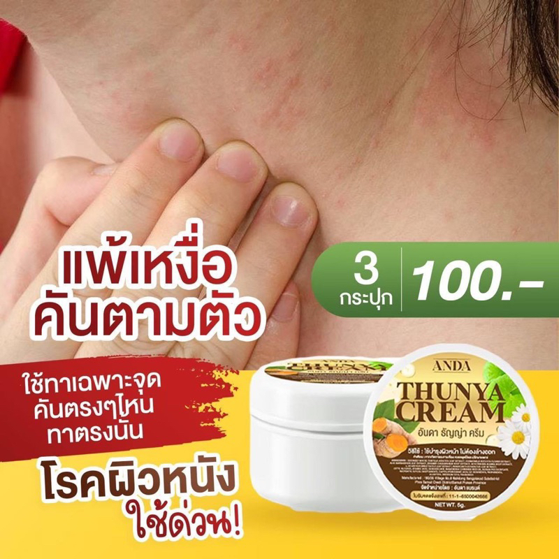 ครีมธัญญ่า สมุนไพรแท้ 100% กำจัดโรคผิวหนัง ขนาด 5 กรัม สินค้าพร้อมส่ง