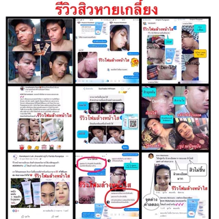 โฟมล้างหน้า 90g 2 ชิ้น DERRATU 🔷ลดสิวอุดตัน🔶ลดสิวหน้าใส ลดมัน ลดแผลสิว หลุมสิวตื้น รูขุมขนกระชับ