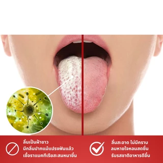 เครื่องขูดลิ้น 4 ชิ้น ที่ขูดลิ้นสแตนเลสทรง U-Shape ที่ขูดลิ้น ลดแบคทีเรียในช่องปาก แก้ปัญหาแปรงฟันไม่สะอาดปากเหม็