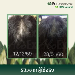 [แพ็คสุดคุ้ม] AloEx Organic Original Shampoo 3 ขวด แชมพูลดผมขาดร่วง สำหรับผมมัน-เหงื่อออกง่าย