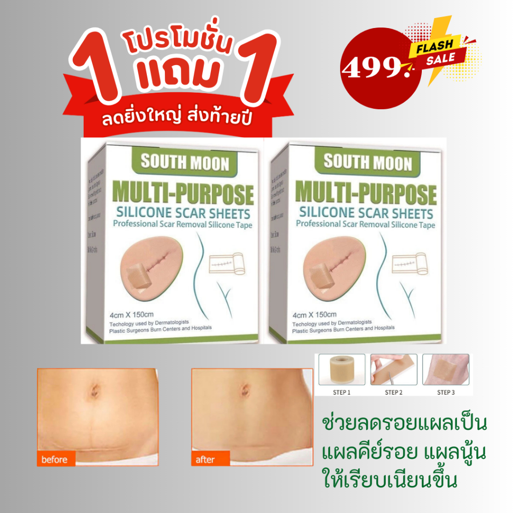 2 กล่อง แผ่นแปะแผลเป็น 4cm*150cm South Moon เทปซิลิโคนเจลรักษารอยแผลเป็น กําจัดรอยแผลเป็นจากแผลเป็น